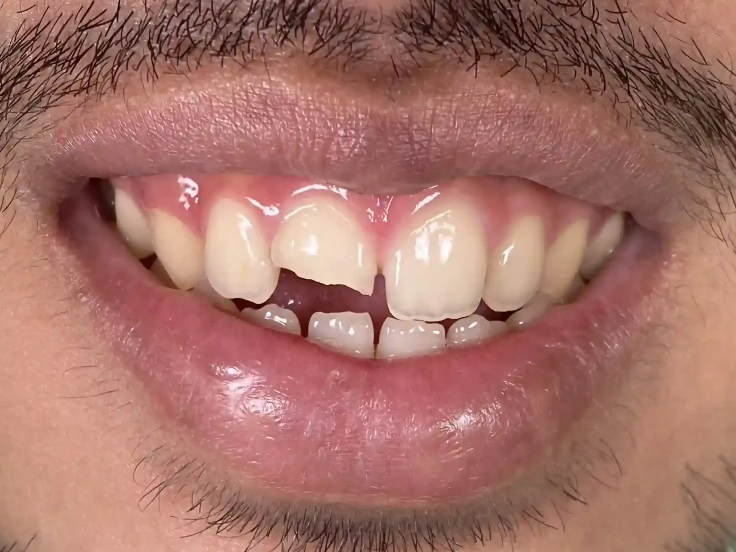 IMG_2028_11zon_1_cropped_11zon