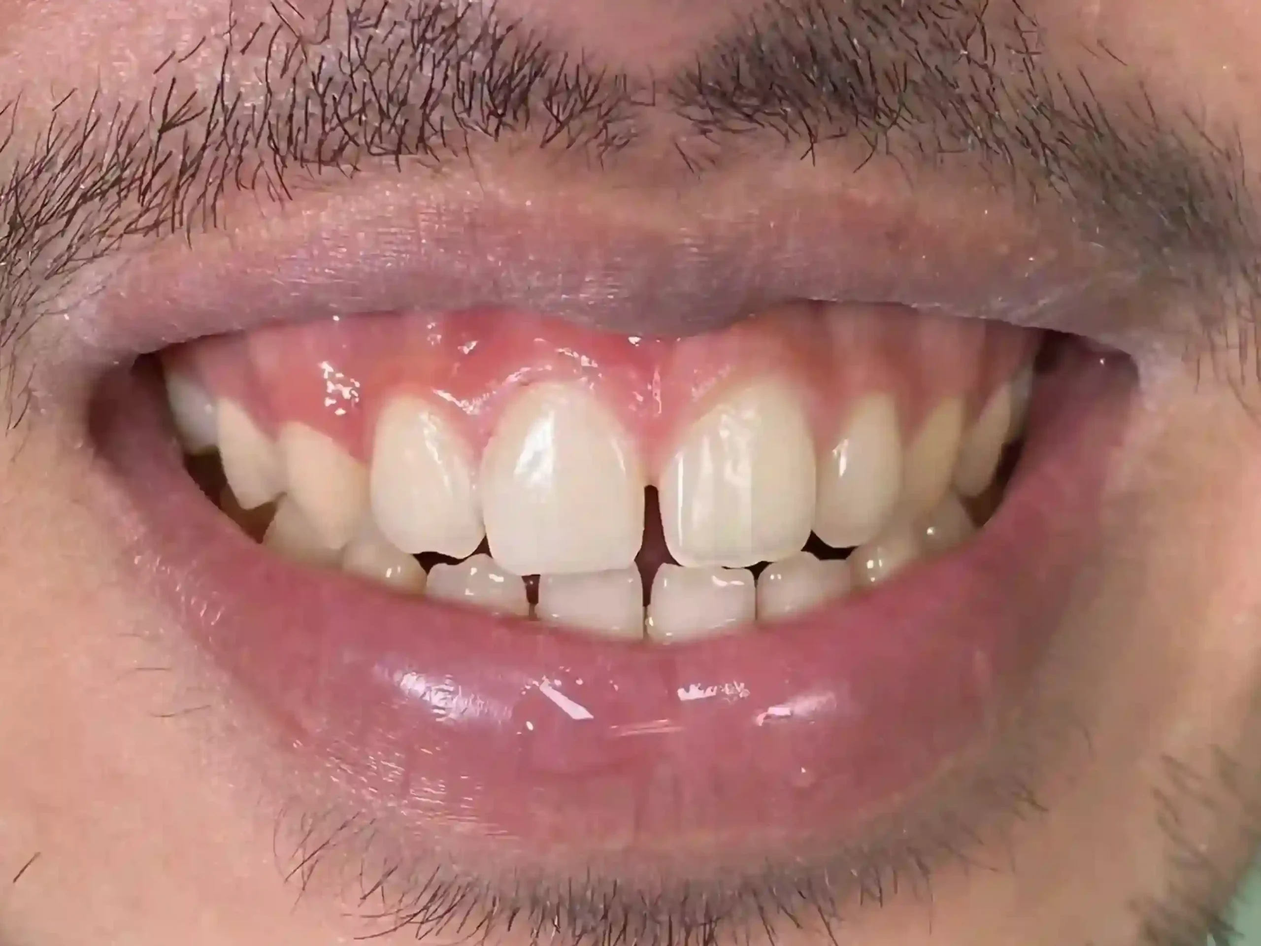 IMG_2031_11zon_cropped_11zon_cropped_11zon