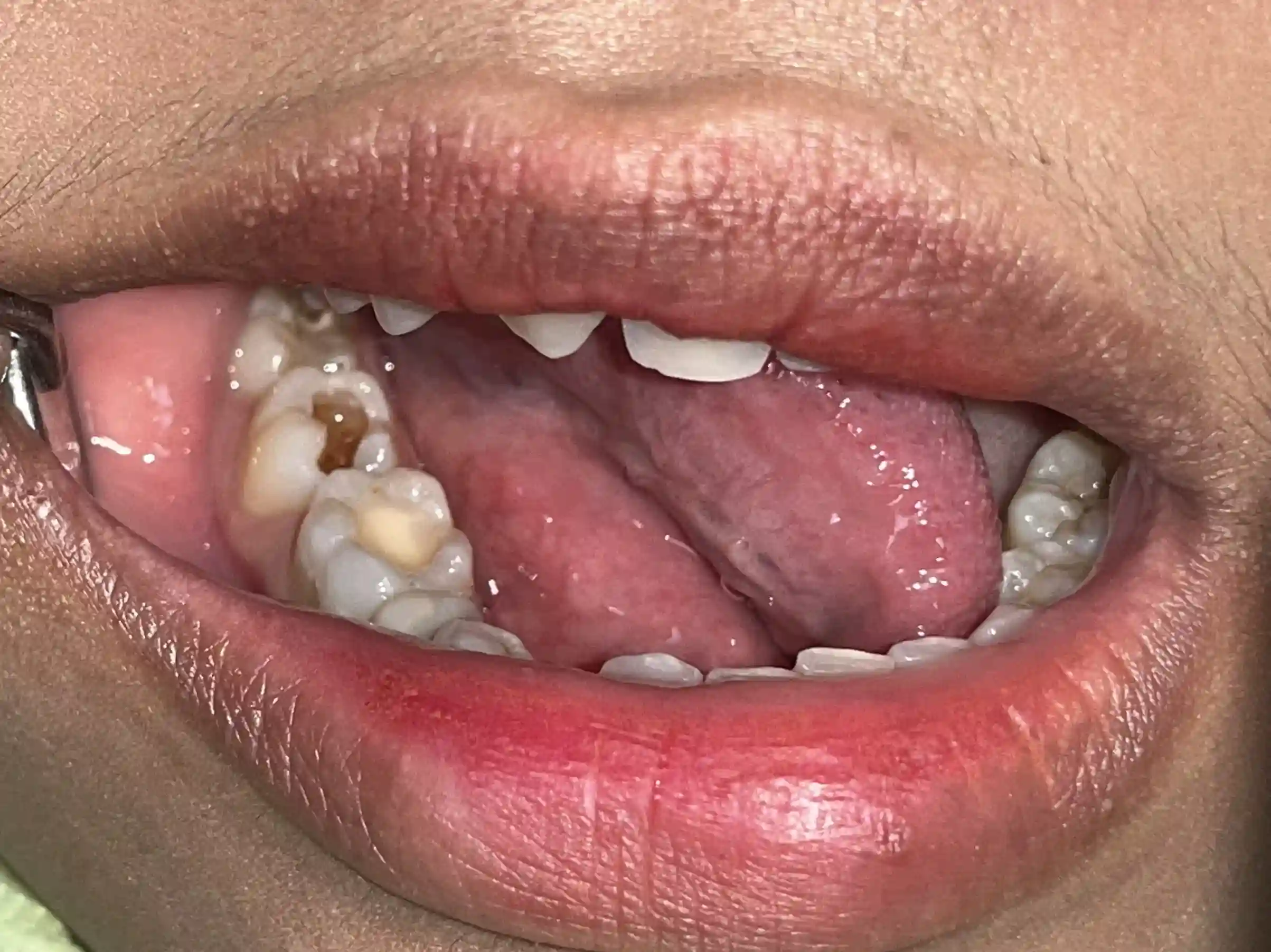 IMG_4554_cropped_11zon