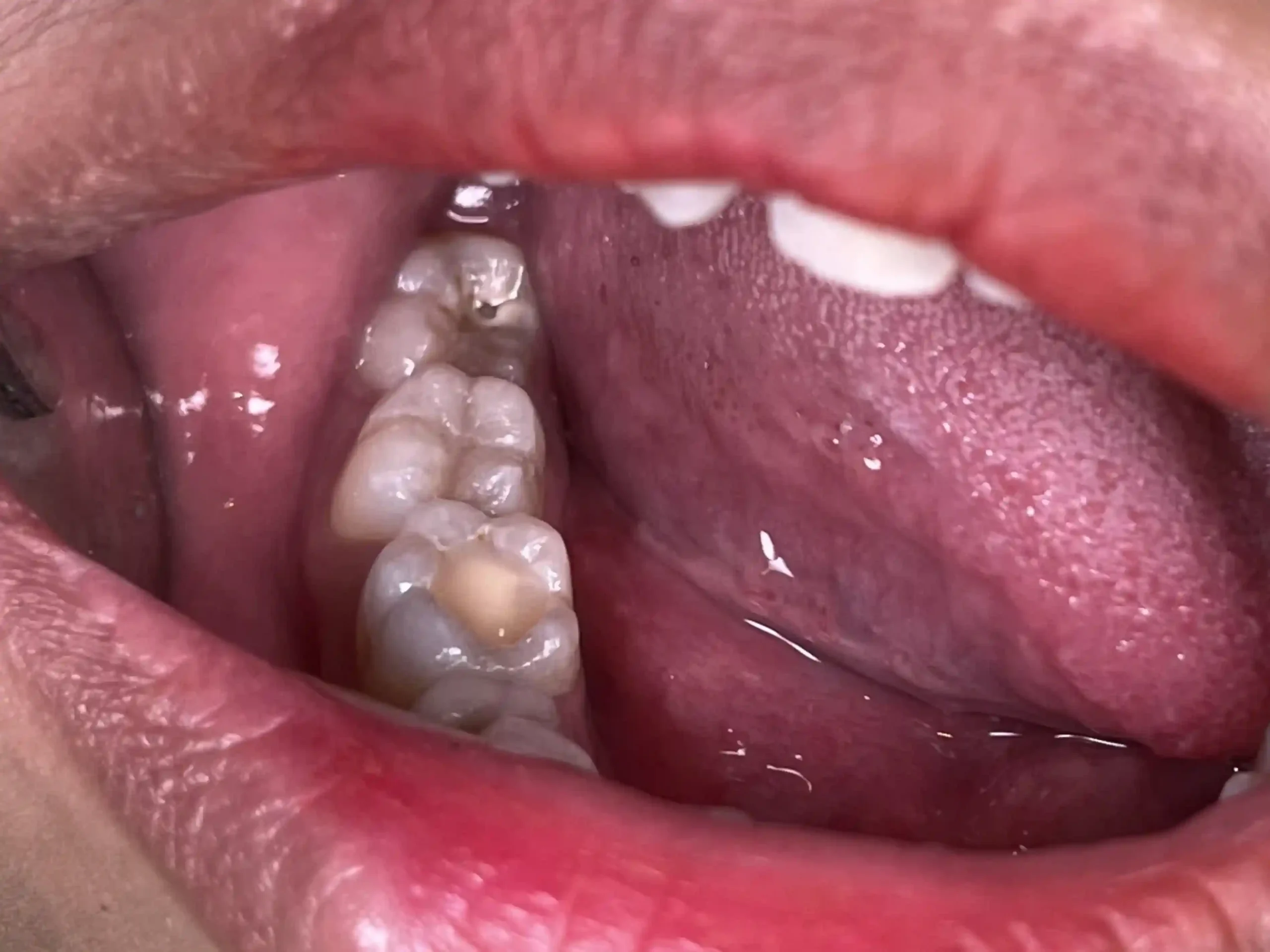 IMG_4556_cropped_11zon