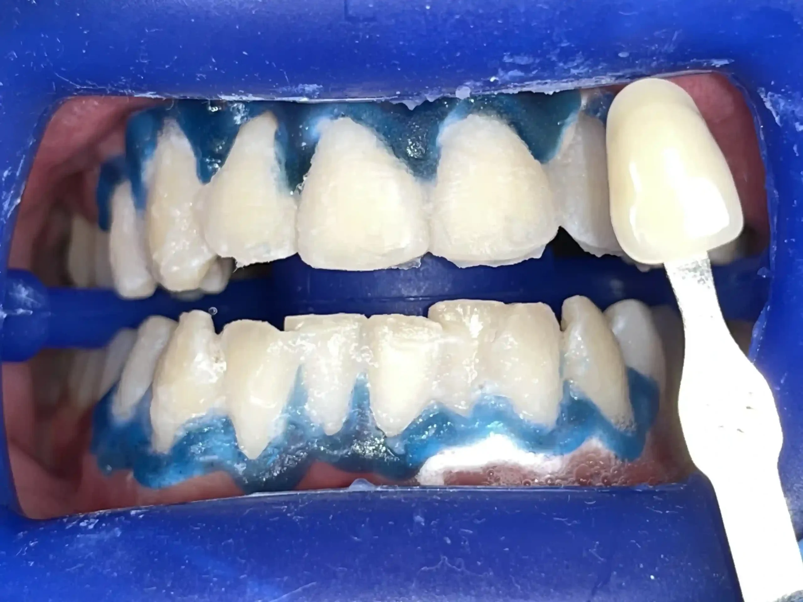 IMG_7559_1_cropped_11zon