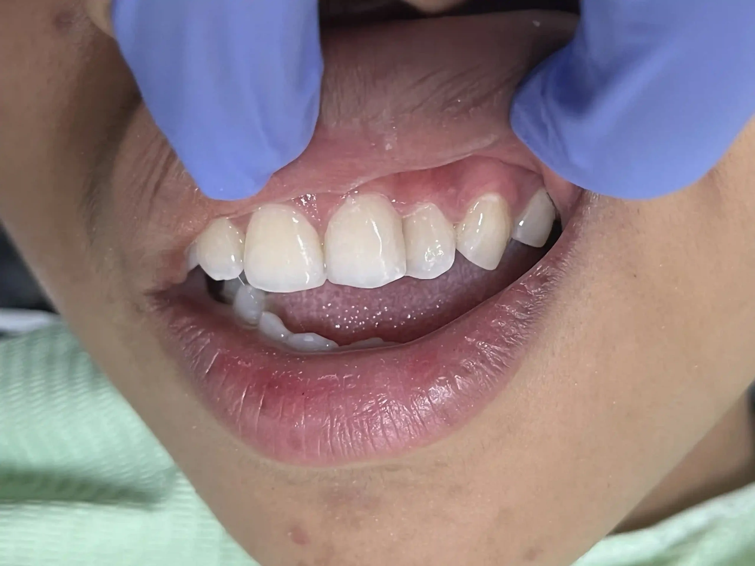 IMG_7653_cropped_11zon