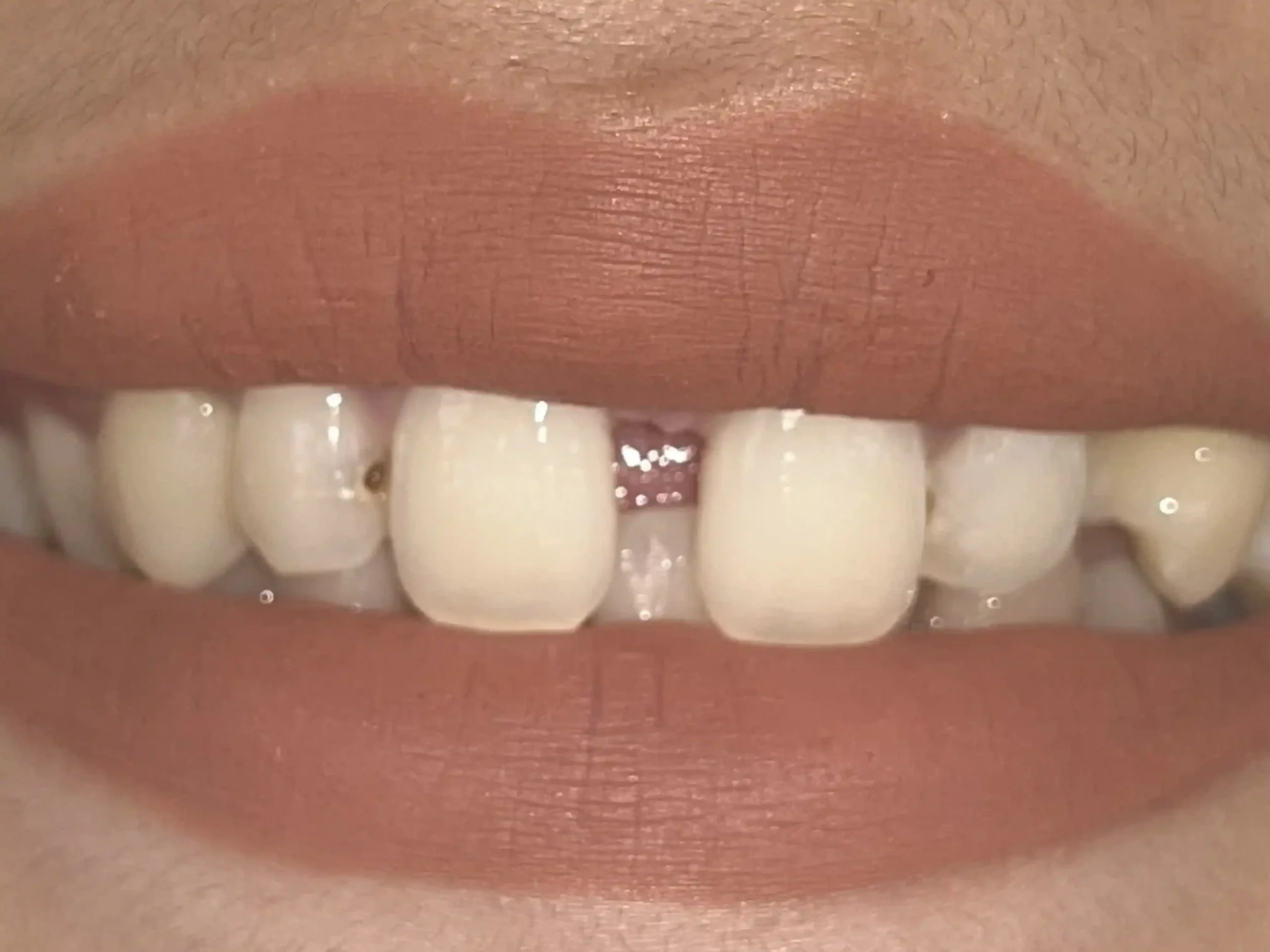 Sudah_1a_cropped_11zon