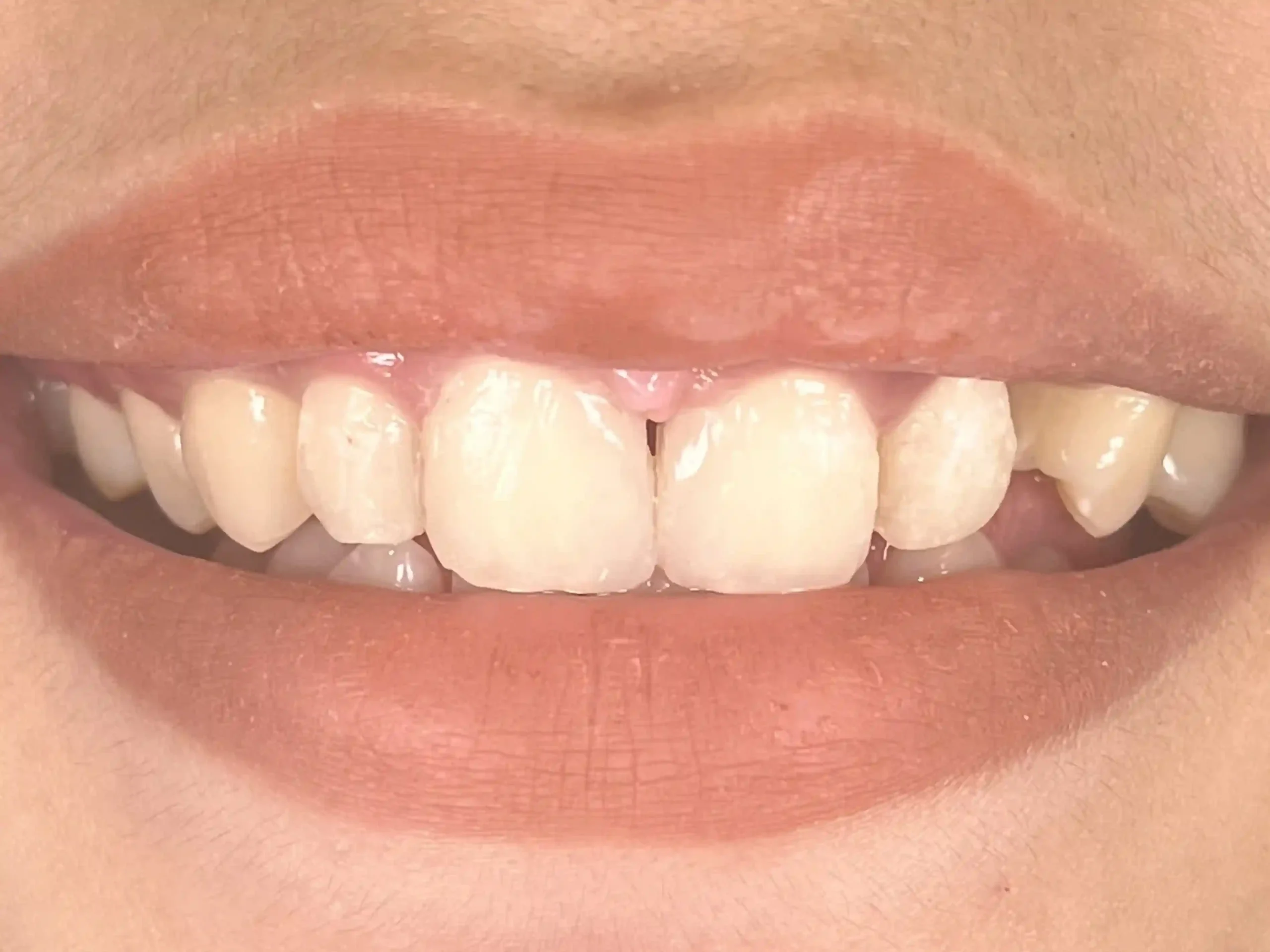 Sudah_1b_cropped_11zon